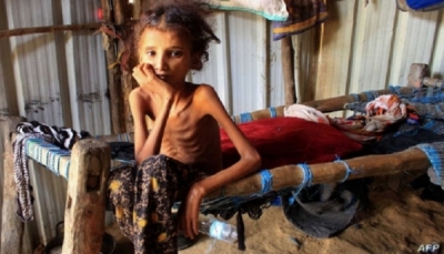 الانهيار الاقتصادي ونقص التمويل أهم الأسباب.. الأمم المتحدة تحذّر من تفاقم الأزمة الإنسانية في اليمن